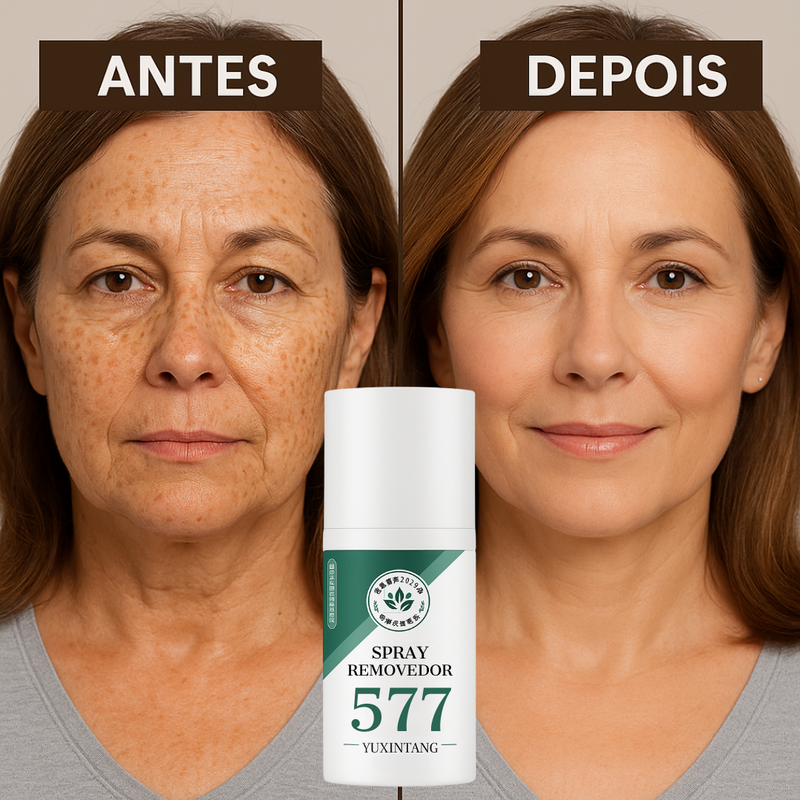 Spray Removedor 577 – Elimine Manchas de Sol, Idade e Melasma